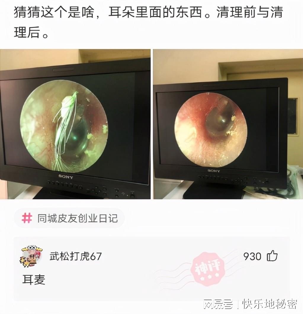 神回复：“慢性自杀”排行榜，你占了几条？